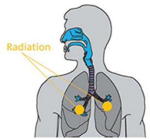 Solarventi Radon